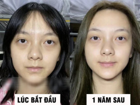 Thử cách chăm sóc da 0 đồng, cô gái đẹp lên không tưởng chỉ sau 1 tháng, làn da như được "tái sinh" hoàn toàn