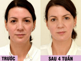 Uống loại nước rẻ tiền này mỗi ngày, người phụ nữ U45 đẹp lên không tưởng chỉ sau 1 tháng, làn da như được "tái sinh" hoàn toàn