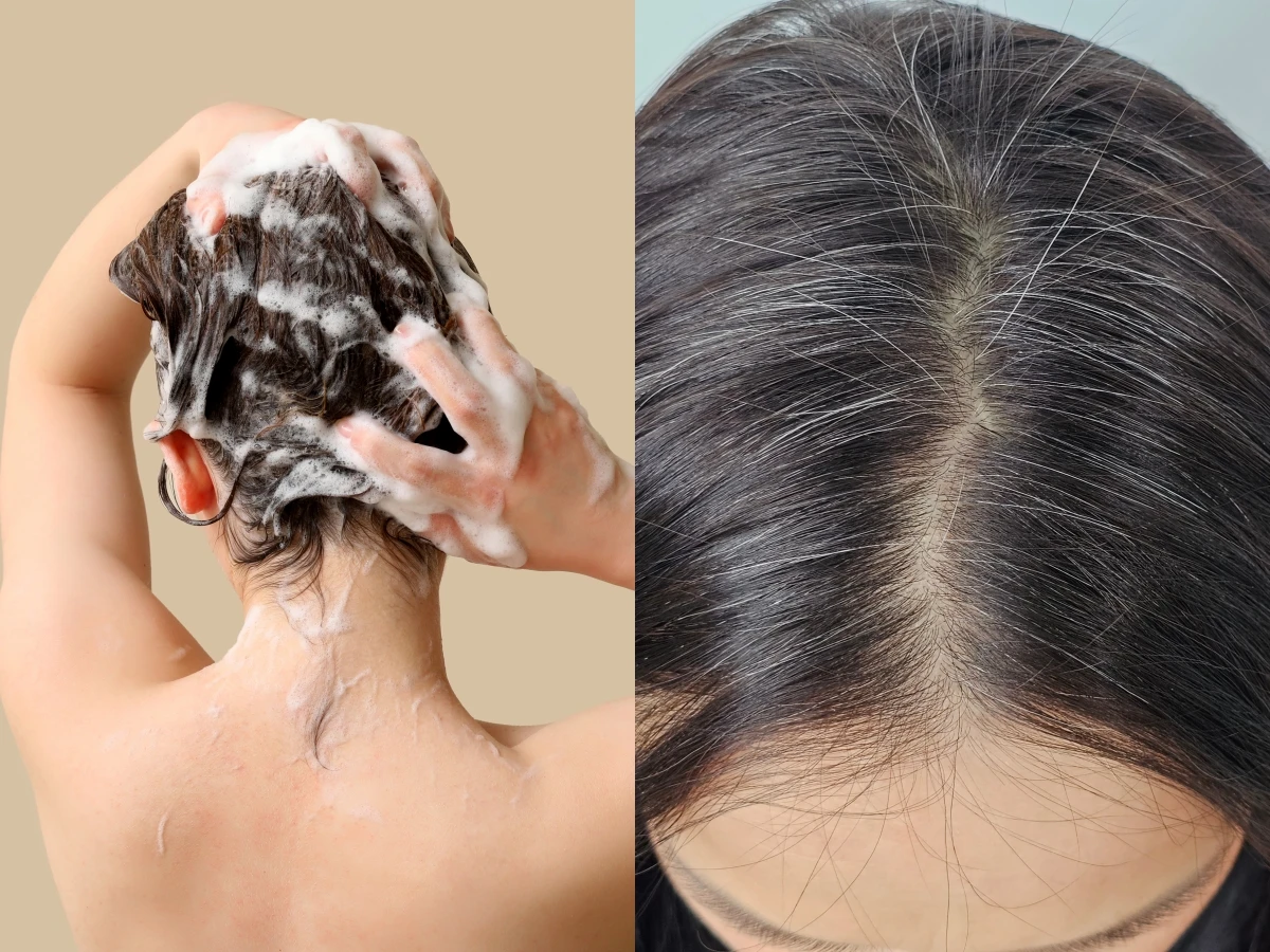 Gội đầu không đúng cách có thể khiến tóc bạc mọc nhiều hơn, nhiều người mắc phải những sai lầm này mỗi ngày - 2