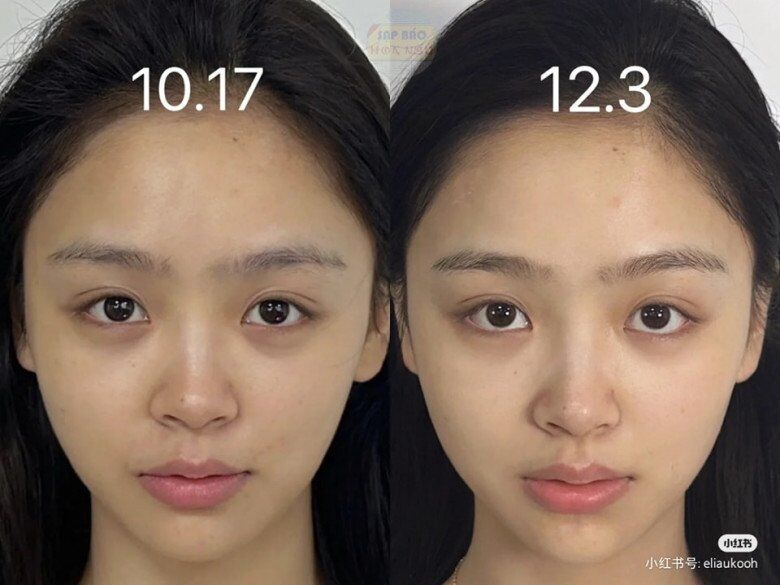 Thử cách chăm sóc da 0 đồng, cô gái đẹp lên không tưởng chỉ sau 1 tháng, làn da như được &#34;tái sinh&#34; hoàn toàn - 6