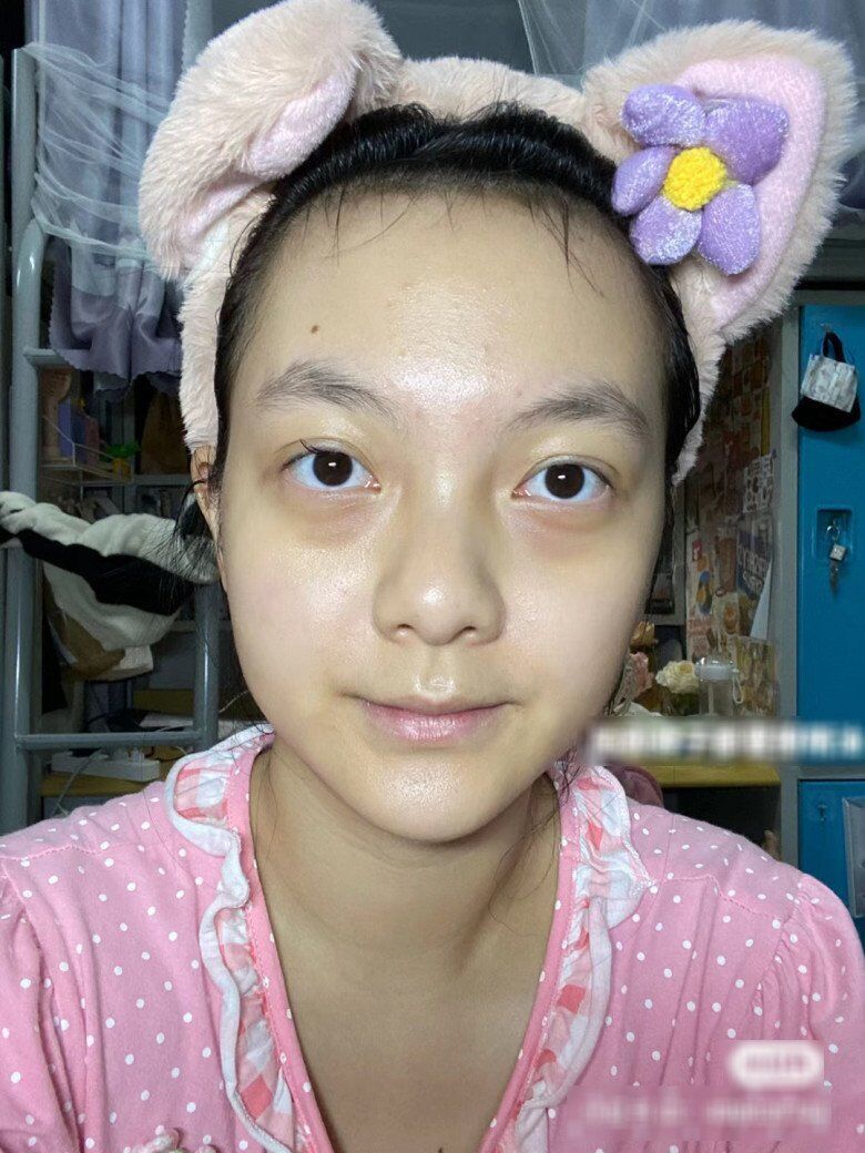 Thử cách chăm sóc da 0 đồng, cô gái đẹp lên không tưởng chỉ sau 1 tháng, làn da như được &#34;tái sinh&#34; hoàn toàn - 1