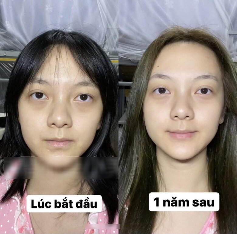 Thử cách chăm sóc da 0 đồng, cô gái đẹp lên không tưởng chỉ sau 1 tháng, làn da như được &#34;tái sinh&#34; hoàn toàn - 3