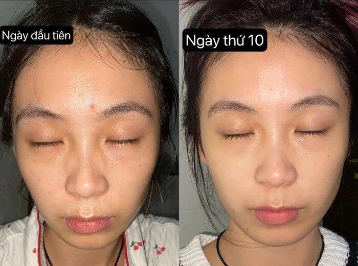 Thử cách chăm sóc da 0 đồng, cô gái đẹp lên không tưởng chỉ sau 1 tháng, làn da như được &#34;tái sinh&#34; hoàn toàn - 8
