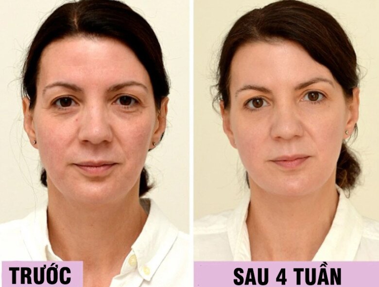 Uống loại nước rẻ tiền này mỗi ngày, người phụ nữ U45 đẹp lên không tưởng chỉ sau 1 tháng, làn da như được &#34;tái sinh&#34; hoàn toàn - 1