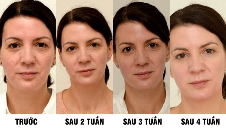 Uống loại nước rẻ tiền này mỗi ngày, người phụ nữ U45 đẹp lên không tưởng chỉ sau 1 tháng, làn da như được &#34;tái sinh&#34; hoàn toàn - 2