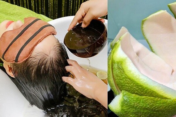 Từ chuyện Puka rụng tóc cả nắm sau sinh, dân tình chỉ ngay 5 bí quyết dân gian giúp mọc tóc từ loạt &#34;thần dược&#34; vừa rẻ vừa hiệu quả - 3