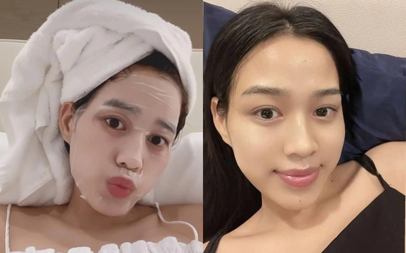 Tôi đều đặn đắp mặt nạ mỗi ngày trong 1 tháng: Trải nghiệm thực tế nhận về kết quả bất ngờ và lời cảnh báo từ chuyên gia - 2