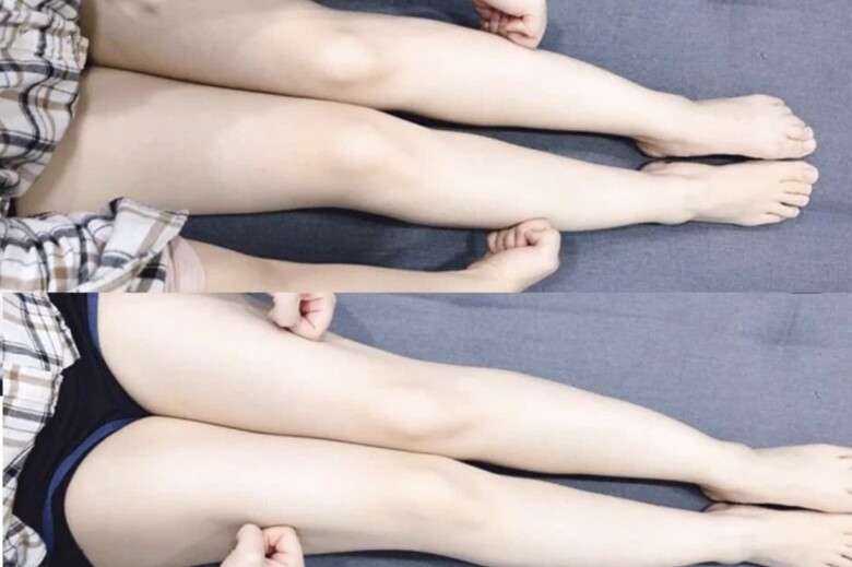 Kiên trì áp dụng 5 động tác massage mỗi ngày giúp &#34;nữ hoàng dao kéo&#34; thu nhỏ bắp chân, vừa an toàn lại hiệu quả - 6