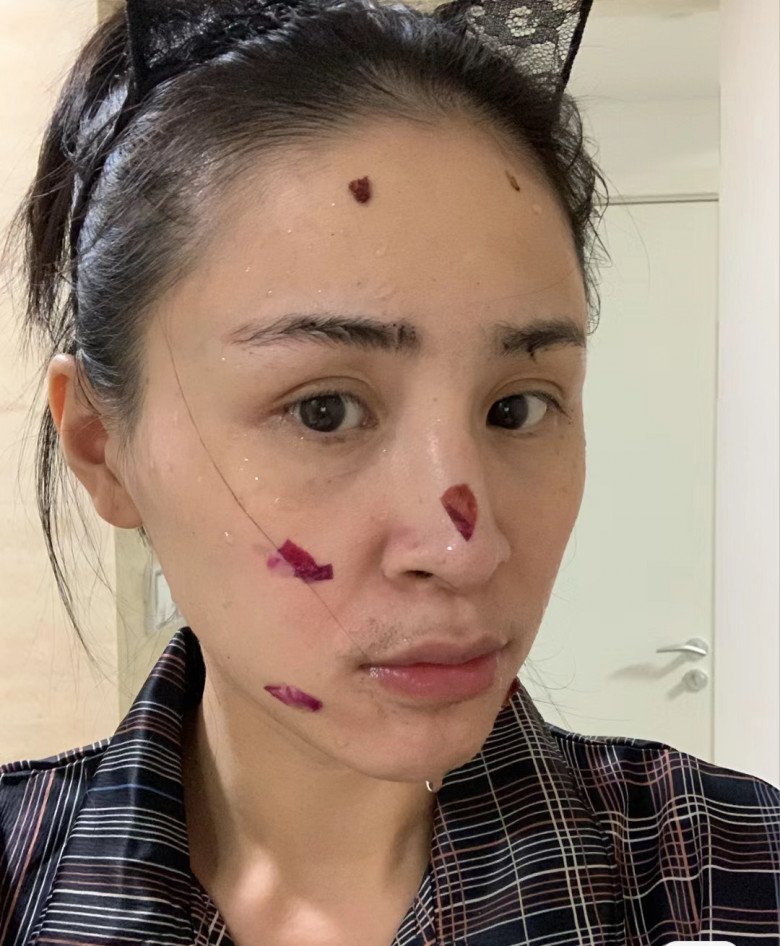 Hoa hồng cắm xong không vứt vội, mẹ bỉm sữa ngâm với 1 thứ rồi thoa lên mặt, kết quả &#34;tái sinh&#34; làn da bất ngờ - 3