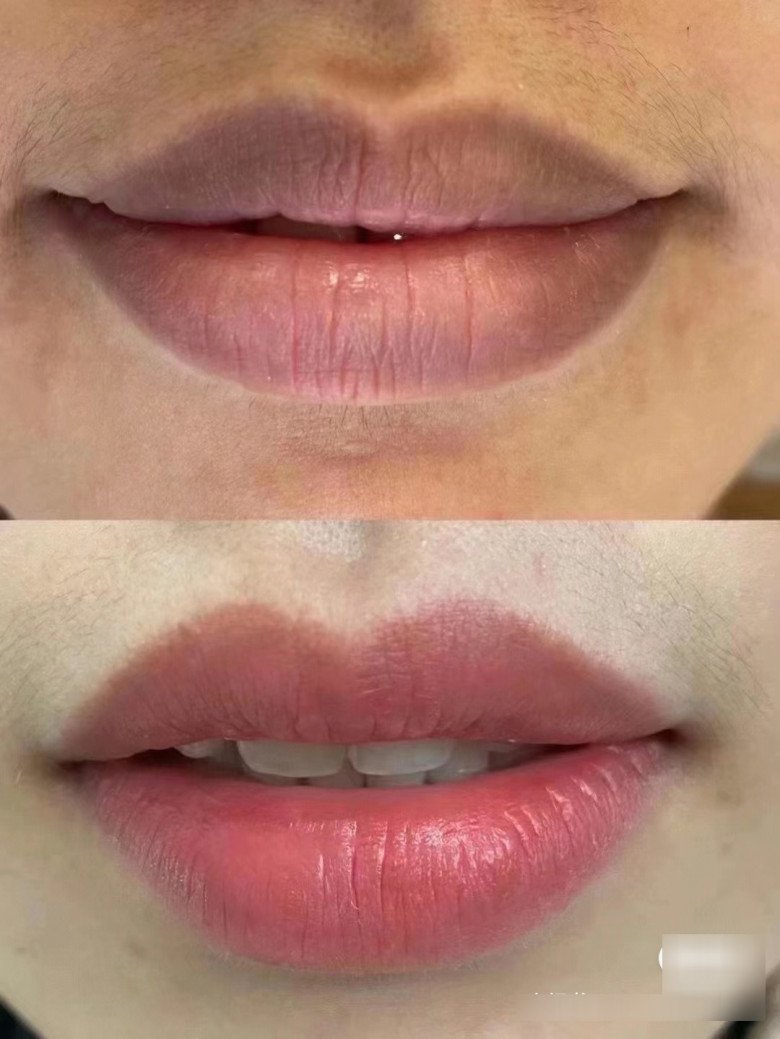 Phát hiện loại củ đỏ ngầu, phụ nữ chà lên môi trị thâm thần kỳ, mang ép lấy nước &#34;lãi&#34; da đẹp, dáng thon - 3