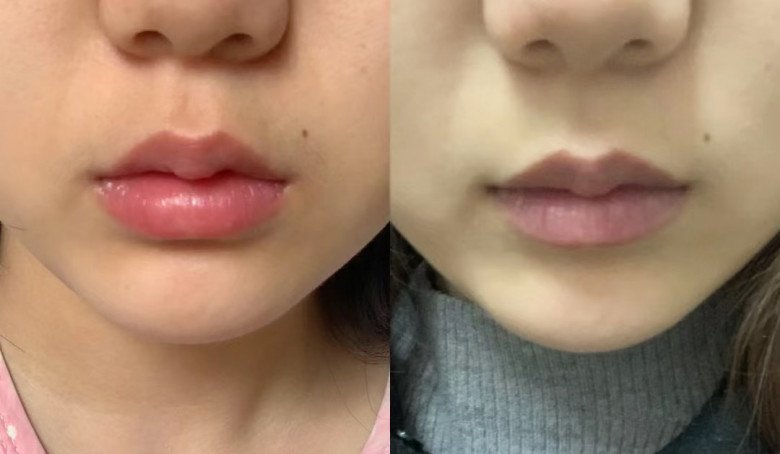 Phát hiện loại củ đỏ ngầu, phụ nữ chà lên môi trị thâm thần kỳ, mang ép lấy nước &#34;lãi&#34; da đẹp, dáng thon - 1