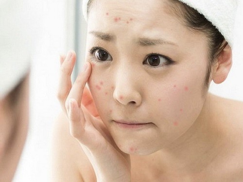Nên buộc tóc hay xoã tóc khi đi ngủ? Câu trả lời khiến chị em nào cũng bất ngờ - 5