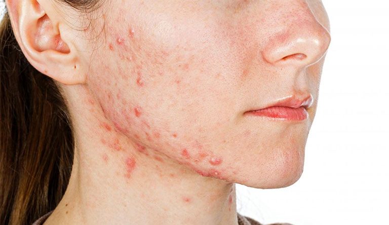 Chăm đủ 7749 bước mà da body vẫn sần sùi đen nhẻm, có thể bạn đang phạm sai lầm này! - 3