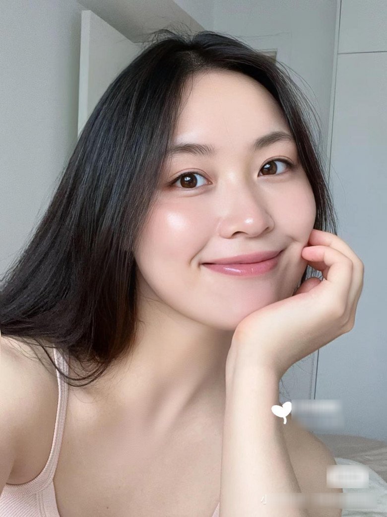Dùng thứ nước 0 đồng dưỡng da, người trắng bật tông, người mọc mụn tràn lan vì sao? - 4