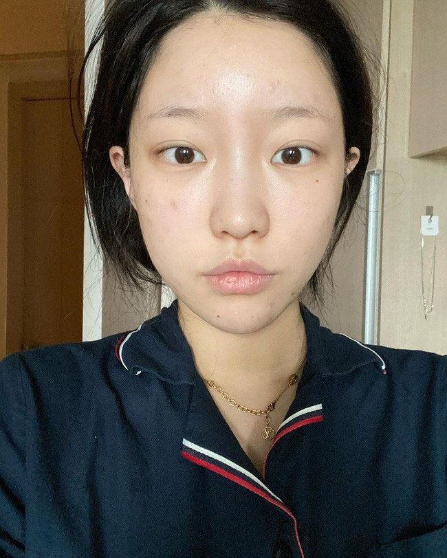 Dùng thứ nước 0 đồng dưỡng da, người trắng bật tông, người mọc mụn tràn lan vì sao? - 6