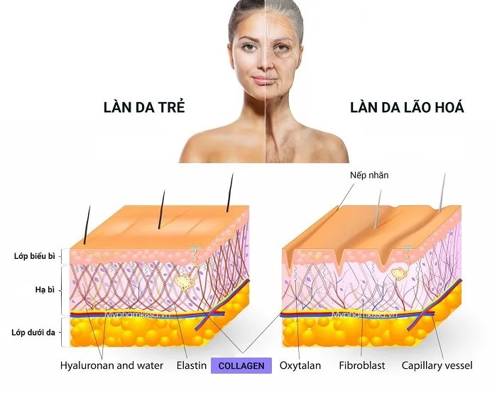 5 nguồn tăng sinh collagen bình dân, giúp làn da “tái sinh”, U40 học theo chồng khen đẹp, bạn bè xin bí quyết - 1