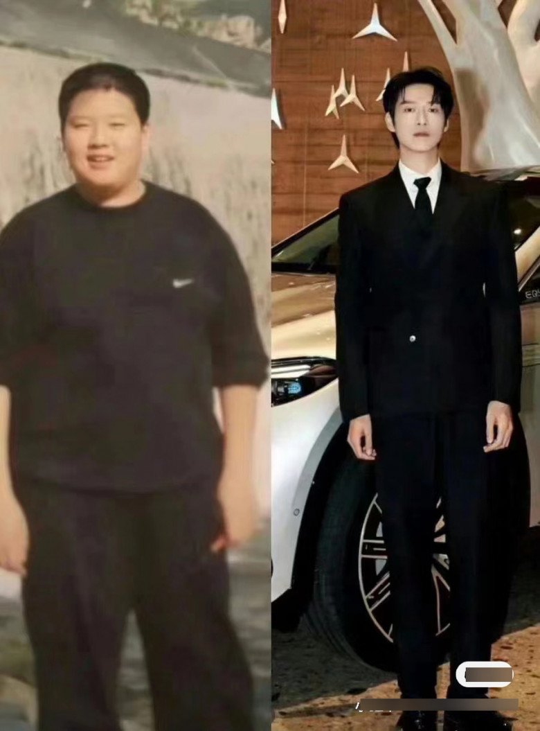 Rộ lên phương pháp phẫu thuật thẩm mỹ &#34;0&#34; đồng, chẳng đau đớn mà gọn mặt thần kỳ - 7
