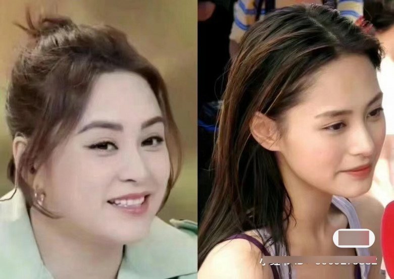 Rộ lên phương pháp phẫu thuật thẩm mỹ &#34;0&#34; đồng, chẳng đau đớn mà gọn mặt thần kỳ - 5