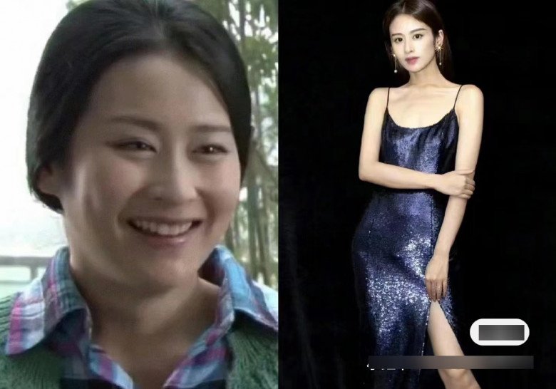 Rộ lên phương pháp phẫu thuật thẩm mỹ &#34;0&#34; đồng, chẳng đau đớn mà gọn mặt thần kỳ - 4