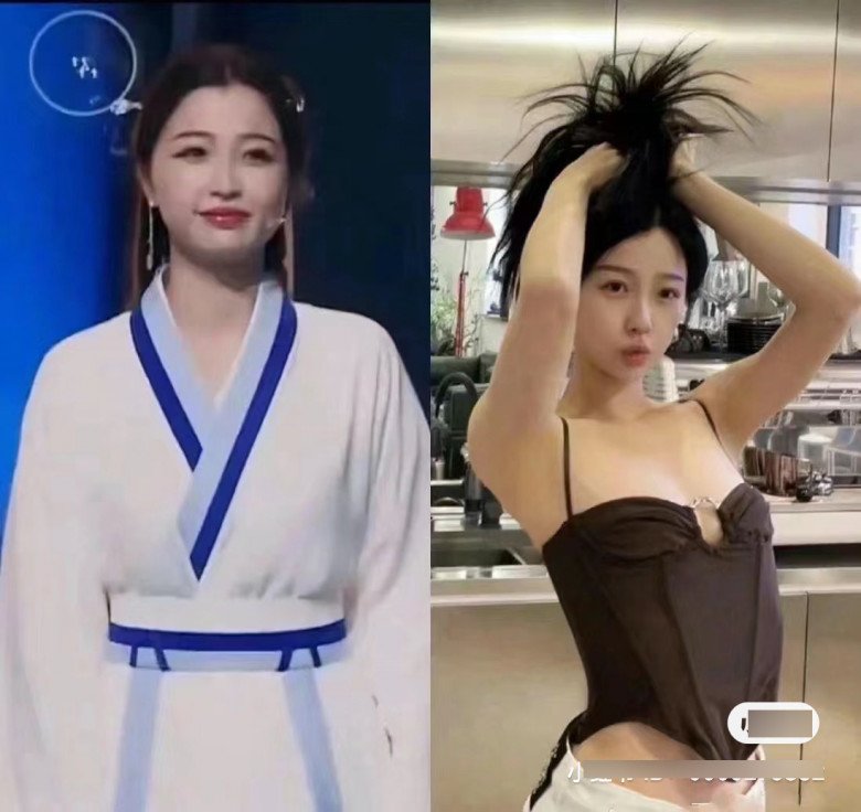 Rộ lên phương pháp phẫu thuật thẩm mỹ &#34;0&#34; đồng, chẳng đau đớn mà gọn mặt thần kỳ - 3
