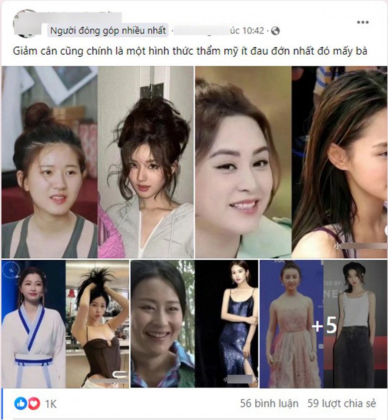 Rộ lên phương pháp phẫu thuật thẩm mỹ &#34;0&#34; đồng, chẳng đau đớn mà gọn mặt thần kỳ - 1