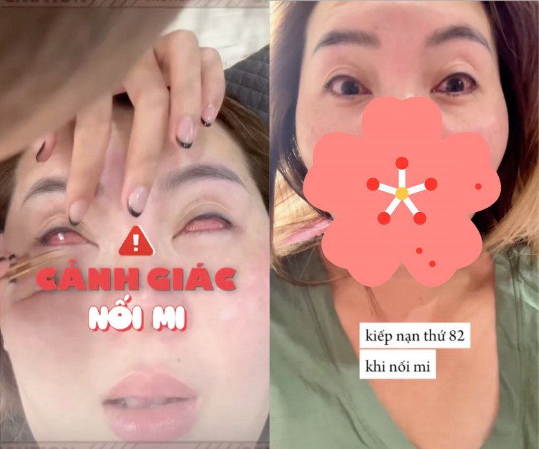 Beauty Blogger bị bỏng khi đi nối mi, giác mạc thành từng lỗ: Lời cảnh tỉnh cho chị em - 1