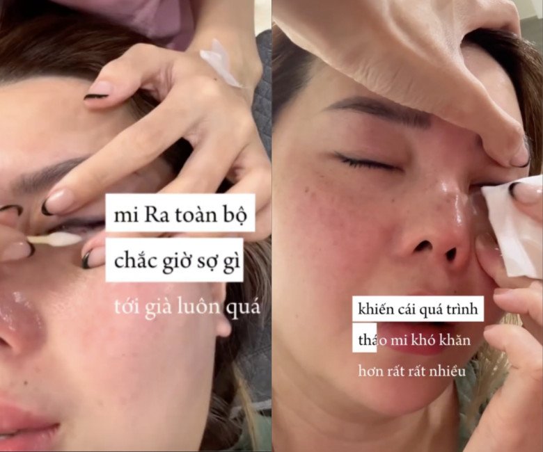 Beauty Blogger bị bỏng khi đi nối mi, giác mạc thành từng lỗ: Lời cảnh tỉnh cho chị em - 2