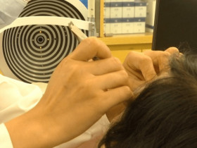 Đang dụi mắt bất ngờ thấy vật lạ rơi ra, người phụ nữ sợ hãi vội vào viện, phát hiện ra thứ kinh dị