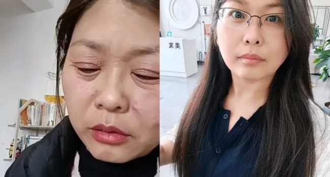 Người phụ nữ 42 tuổi biến thành bà lão U70 sau gần một tháng, 2 mốc thời gian nam, nữ cần chú ý kẻo già nhanh - 1