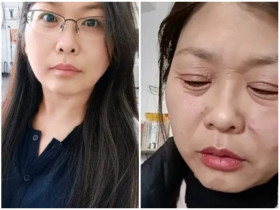 Người phụ nữ 42 tuổi biến thành bà lão U70 sau gần một tháng, 2 mốc thời gian nam, nữ cần chú ý kẻo già nhanh