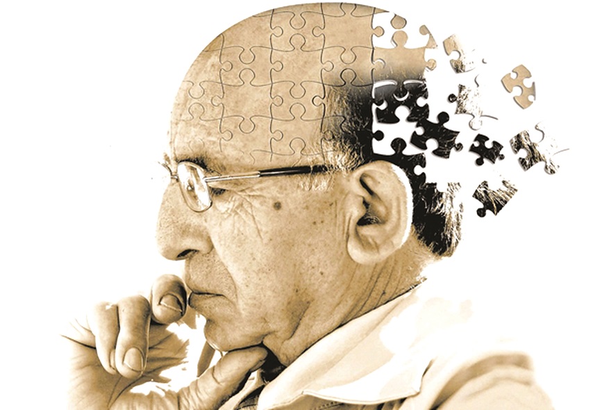 Sa sút trí tuệ do Alzheimer - 1