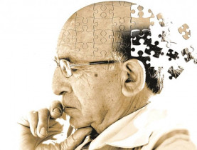 Sa sút trí tuệ do Alzheimer