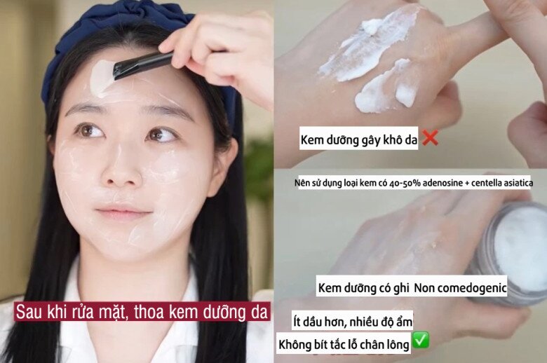 Thoa kem dưỡng ẩm mùa đông, bác sĩ da liễu bật mí nên dùng thêm giấy thấm dầu vì sao? - 2