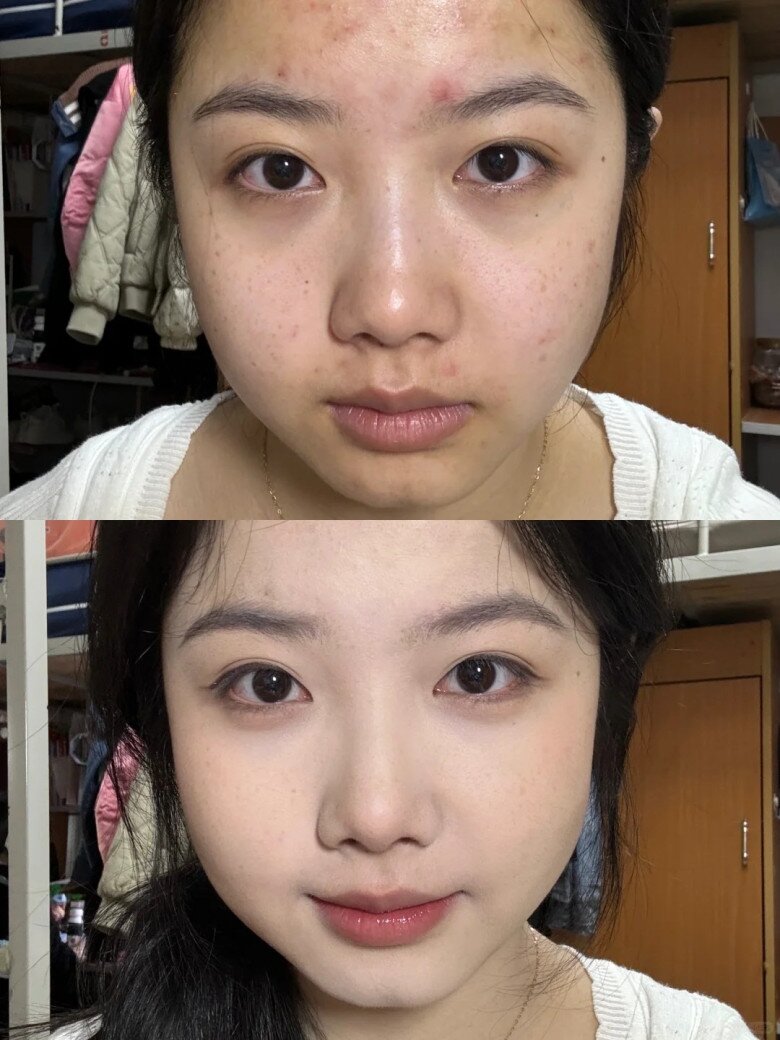 Thoa kem chống nắng hay kem che khuyết điểm trước để có làn da đẹp? Nhiều chị em makeup mỗi ngày vẫn sai - 5