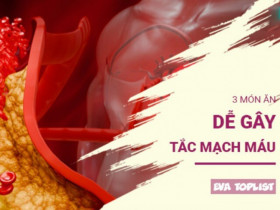 3 món ăn "sát thủ thầm lặng" đang âm thầm tắc nghẽn mạch máu của bạn