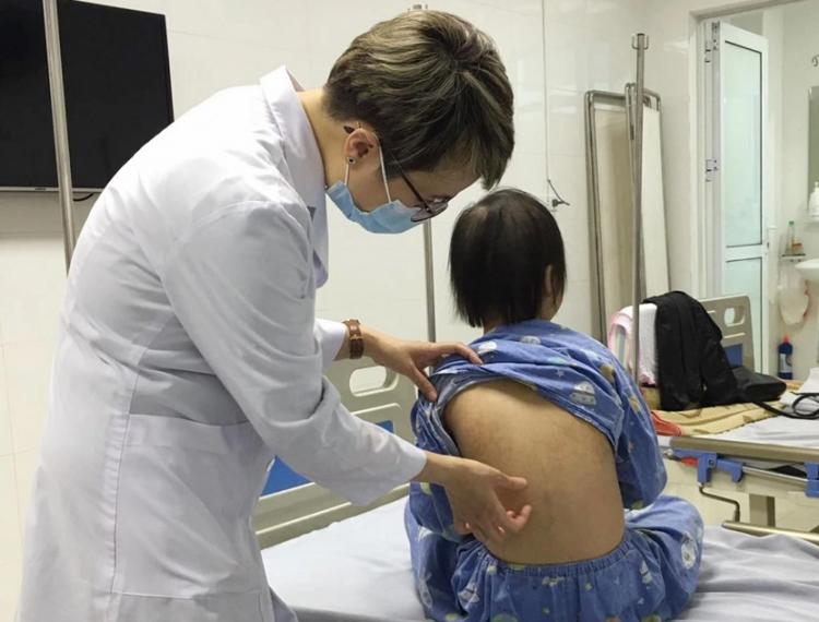 Bệnh da liễu ở trẻ em