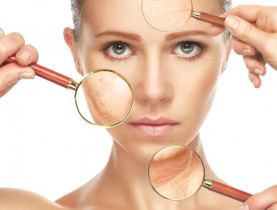 Mẹo trang điểm mùa đông