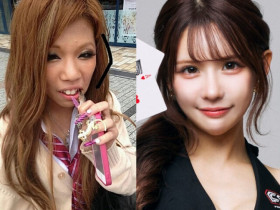 Cô gái "vịt hóa thiên nga" sau khi chi 4 tỷ cho hơn 20 cuộc phẫu thuật, nhan sắc trước và sau thẩm mỹ khó tin nổi