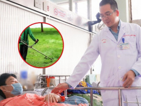 Bác sĩ chạy đua với thời gian, nối thành công bàn chân của 2 bệnh nhân bị tai nạn lao động vì máy cắt cỏ
