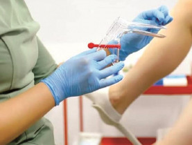 Sùi mào gà ở trẻ vị thành niên