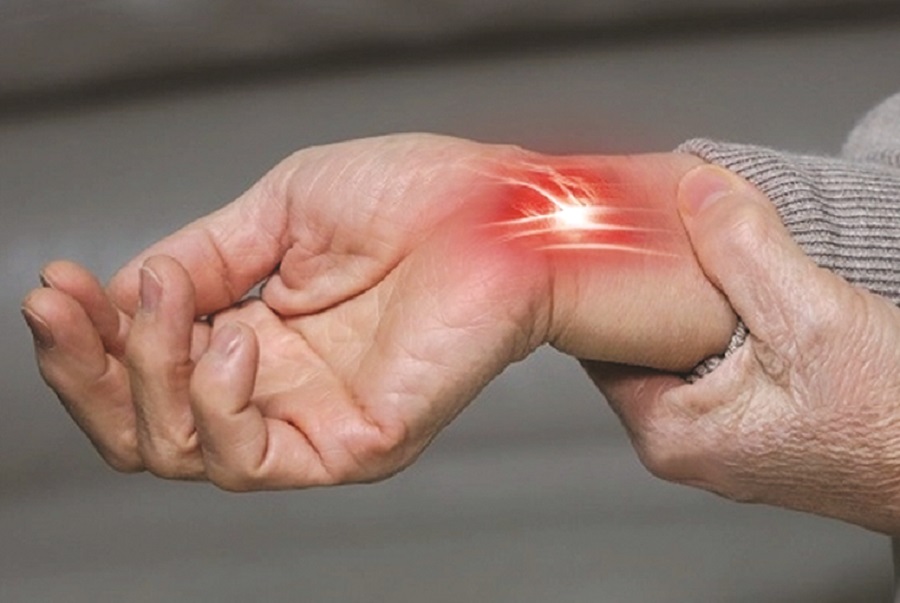 Hội chứng ống cổ tay - 1