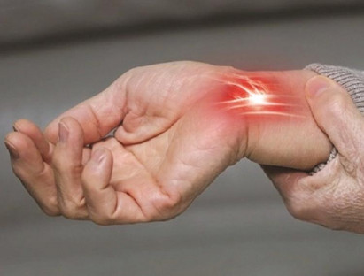 Hội chứng ống cổ tay