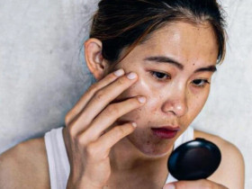 4 bộ phận trên cơ thể bỗng đen lại, có thể đây là tín hiệu “cầu cứu”, đừng chớ chủ quan