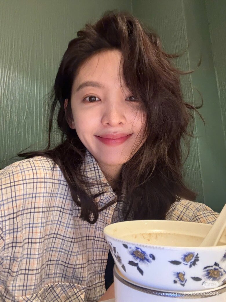 Nữ diễn viên là &#34;người tình trong mộng&#34; ở xứ tỷ dân: Nhan sắc hút 70 triệu lượt xem, nay chân &#34;teo tóp&#34; ai nhìn cũng sợ - 6