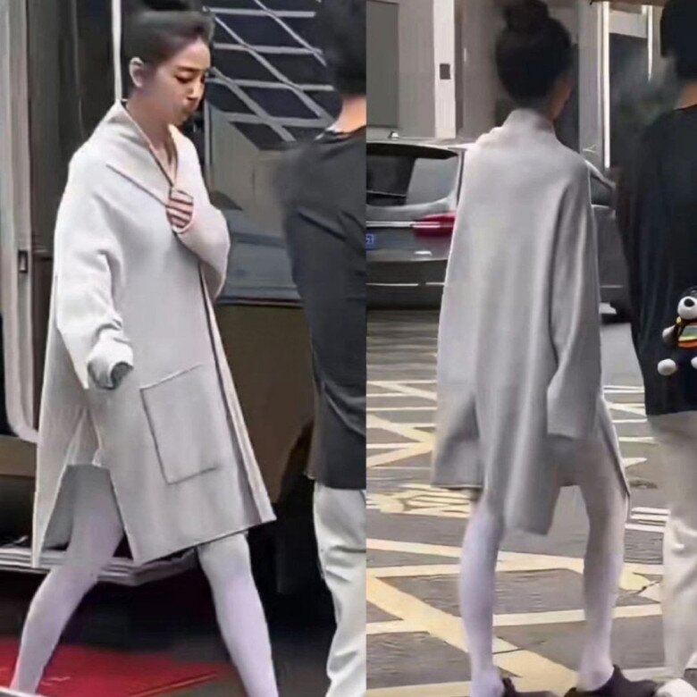 Nữ diễn viên là &#34;người tình trong mộng&#34; ở xứ tỷ dân: Nhan sắc hút 70 triệu lượt xem, nay chân &#34;teo tóp&#34; ai nhìn cũng sợ - 2