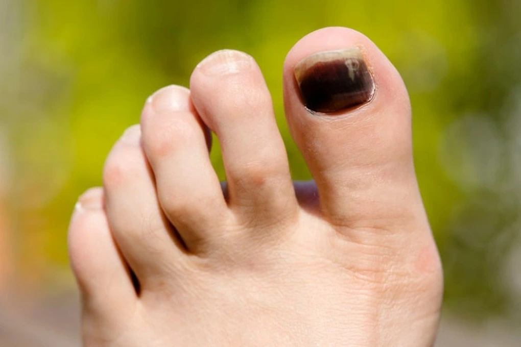 Chỉ cần nhìn vào màu sắc 3 bộ phận của bàn chân cũng có thể biết ai có sức khỏe tốt, sống thọ - 3