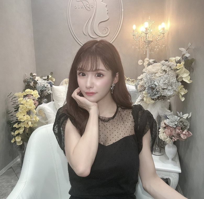 Cô gái "vịt hóa thiên nga" sau khi chi 4 tỷ cho hơn 20 cuộc phẫu thuật, nhan sắc trước và sau thẩm mỹ khó tin nổi - 11