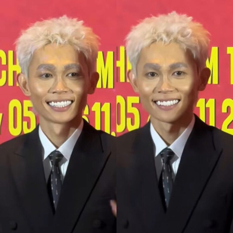 Mặt hốc hác, vóc dáng không còn như xưa, diện mạo tình cũ DJ Mie sau chia tay khiến dân tình ngỡ ngàng - 2