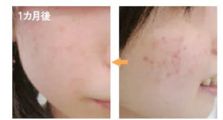 Người phụ nữ U60 trẻ như gái 18 nhờ chăm rửa mặt theo cách độc lạ, dùng một loại gia vị có ngay trong bếp - 5