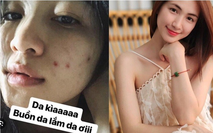 Người Việt có loại lá tốt ngang kem chống nắng, trị mụn hiệu quả đến Hòa Minzy cũng thích nhưng nhiều chị em không dám dùng - 2